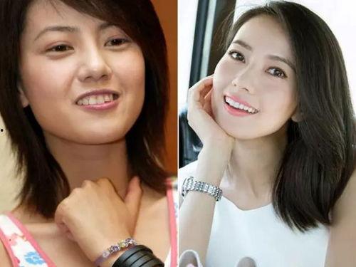 明星牙齿整齐图片,整齐笑容的秘密武器